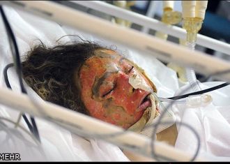 About 30 students suffer burns in heater fire in northwestern Iran