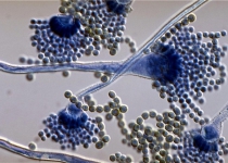 Iranian researchers produce nanobiosensor to detect fungi