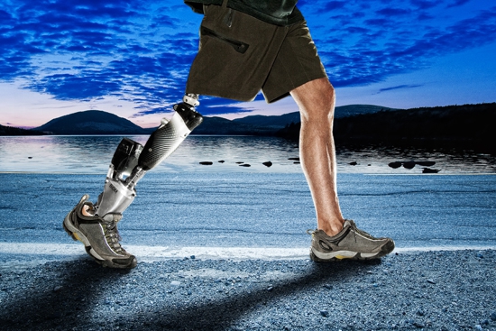 Iranian scientist designs natural artificial leg with advanced ankle