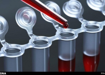Iranian researcher designs simple blood test to detect cancer 