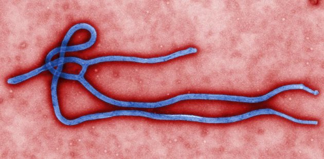 Global Ebola death toll tops 1,000: WHO