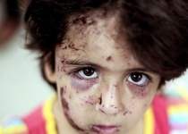 1000s of Gaza children need psychological care: UN