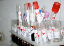 Iran produces Hepatitis B kit