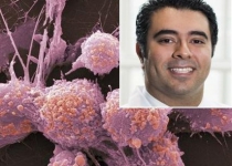 Iranian researcher: Targeted MRI/ultrasound effective in identifying prostate cancer