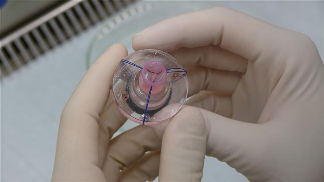 Iranian scientists create worlds first hybrid heart valve