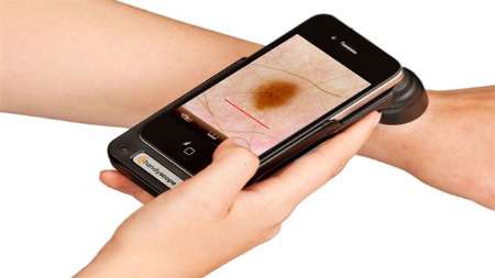 Iranian develops skin cancer-detecting smartphone