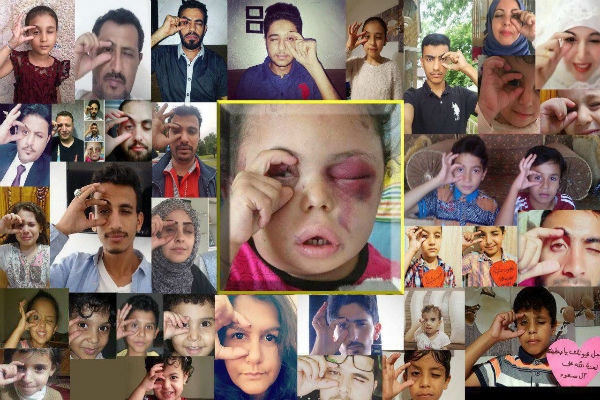 #I_Speak_For_Buthaina: An international hashtag to condemn Saudi violence