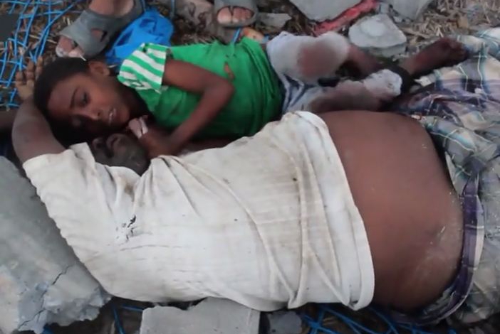 Why Yemeni boy clinging to fathers corpse for hours makes no headlines?