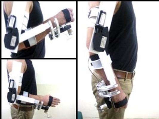 Robot developed to help patients with spinal cord injuries