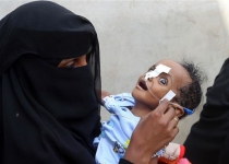 UN: 8.4 million war-hit Yemenis need urgent food aid