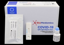 Iran produces COVID-19 antibody rapid test kit: Health Min. spox